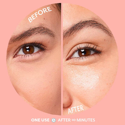 Serve Chilled Bubbly Eye Gels (5 Pack)